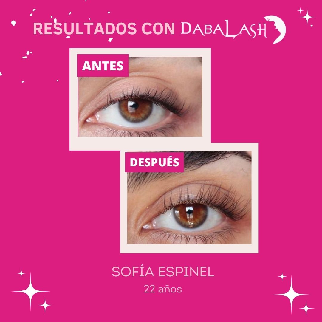 Testimonios de crecimiento de pesta&ntilde;as 